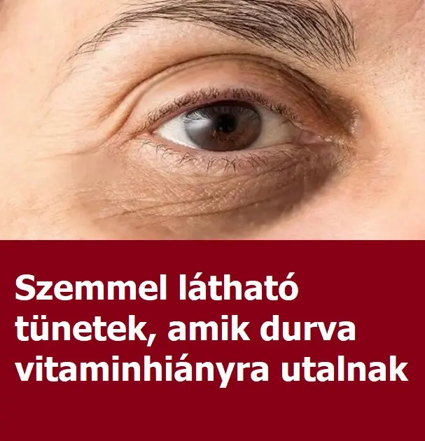 szemvitamin381